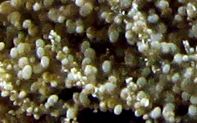Knobby Sea Anemone - Ragactis lucida